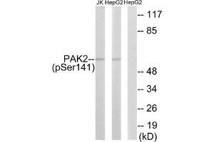 Western blot analysis of extracts from HepG2 cells treated with Adriamycin (0. (PAK2 anticorps  (pSer141))
