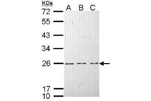 WB Image Sample (30 ug of whole cell lysate) A: Hela B: Hep G2 , C: Molt-4 , 12% SDS PAGE antibody diluted at 1:1000 (HRAS anticorps  (C-Term))