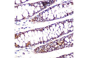 Immunohistochemistry of paraffin-embedded human colon using DLDH/DLD Rabbit mAb (ABIN7266766) at dilution of 1:100 (40x lens). (DLD anticorps)