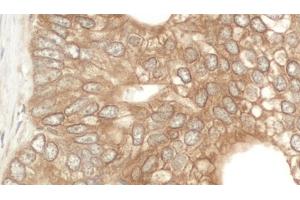 Immunohistochemistry (IHC) image for anti-E3 ubiquitin-protein ligase NEDD4-like (NEDD4L) (AA 275-325) antibody (ABIN7453739)