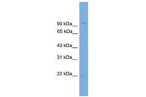 TPPP3 antibody used at 1 ug/ml to detect target protein. (TPPP3 anticorps  (N-Term))