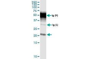 Immunoprecipitation of TMEM126B transfected lysate using rabbit polyclonal anti-TMEM126B and Protein A Magnetic Bead (TMEM126B (Humain) IP-WB Antibody Pair)