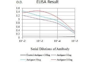 Black line: Control Antigen (100 ng),Purple line: Antigen (10 ng), Blue line: Antigen (50 ng), Red line:Antigen (100 ng)