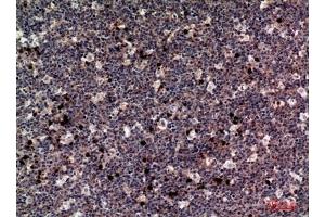 Immunohistochemical analysis of paraffin-embedded human-tonsils, antibody was diluted at 1:100. (M-CSF/CSF1 anticorps  (C-Term))