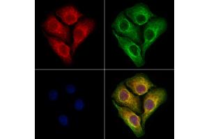 ABIN6264681 and ABIN6273070 staining Hela cells by IF/ICC. (RCN2 anticorps  (C-Term))