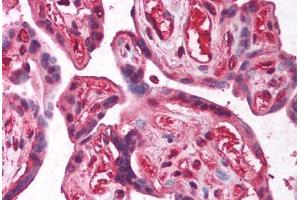 Human Placenta (formalin-fixed, paraffin-embedded) stained with E2F2 antibody ABIN214097 at 5 ug/ml followed by biotinylated goat anti-rabbit IgG secondary antibody ABIN481713, alkaline phosphatase-streptavidin and chromogen.