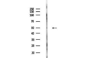 Western blot analysis of lysates from HUVEC cells(LPS,4h treatment), using SLC16 Antibody at 1/1000 dilution.