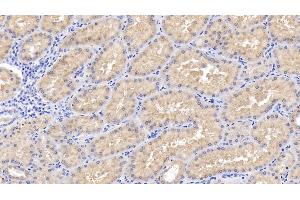 Detection of RIPK3 in Human Kidney Tissue using Polyclonal Antibody to Receptor Interacting Serine Threonine Kinase 3 (RIPK3)