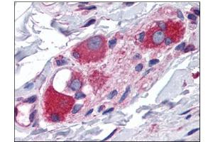 Human Small Intestine, Submucosal Plexus: Formalin-Fixed, Paraffin-Embedded (FFPE) (ARL6IP5 anticorps  (C-Term))