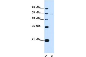 WB Suggested Anti-KYNU Antibody Titration:  0. (KYNU anticorps  (C-Term))