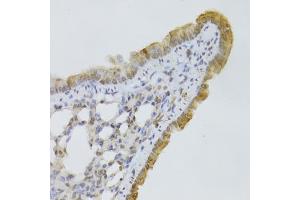 Immunohistochemistry of paraffin-embedded mouse lung using GPD2 Antibody. (GPD2 anticorps)