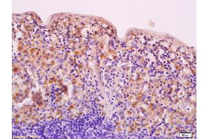 Formalin-fixed and paraffin embedded human brain labeled with Anti-HDAC5 Polyclonal Antibody, Unconjugated (ABIN681043) at 1:200 followed by conjugation to the secondary antibody and DAB staining
