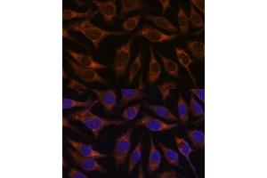 Immunofluorescence analysis of L929 cells using  antibody (ABIN6131176, ABIN6136646, ABIN6136647 and ABIN6222857) at dilution of 1:100.