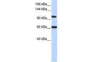 WB Suggested Anti-THRAP3 Antibody Titration:  0. (THRAP3 anticorps  (Middle Region))