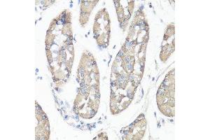 Immunohistochemistry of paraffin-embedded human stomach using PTK2 antibody.