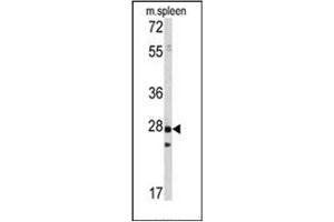 Image no. 1 for anti-Protein Tyrosine Phosphatase Type IVA, Member 1 (PTP4A1) antibody (ABIN360770) (PTP4A1 anticorps)