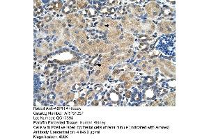 Human kidney (Aspartate beta Hydroxylase anticorps  (N-Term))