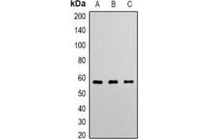 Western blot analysis of Angiopoietin-1 expression in K562 (A), Hela (B), Jurkat (C) whole cell lysates. (Angiopoietin 1 anticorps  (N-Term))
