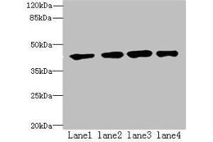 Western blot All lanes: QTRT1 antibody at 6 μg/mL Lane 1: MCF-7 whole cell lysate Lane 2: PC-3 whole cell lysate Lane 3: Jurkat whole cell lysate Lane 4: A431 whole cell lysate Secondary Goat polyclonal to rabbit IgG at 1/10000 dilution Predicted band size: 45, 25 kDa Observed band size: 45 kDa (QTRT1 anticorps  (Catalytic Subunit 1))