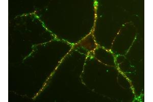 Immunostaining of rat hippocampus neurons with anti-SV2 C (red; dilution: 1 : 500) and anti-synaptophysin (cat.