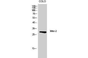 Western Blotting (WB) image for anti-Msh Momeobox 2 (Msx2) (Internal Region) antibody (ABIN3180740) (Msx2/Hox8 anticorps  (Internal Region))