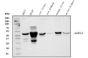 Western blot analysis of ADH1A using anti-ADH1A antibody (ABIN4886427). (ADH1A anticorps  (AA 213-375))
