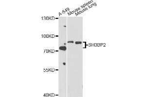 Western blot analysis of extracts of various cell lines, using SH3BP2 antibody (ABIN5998800) at 1/1000 dilution. (SH3BP2 anticorps)