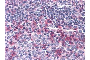 Immunohistochemical analysis of paraffin-embedded human Tonsil tissues using anti-CD69 mouse mAb