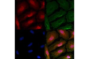 ABIN6263700 and ABIN6266787 staining  cells by IF/ICC. (NPM1 anticorps  (N-Term))