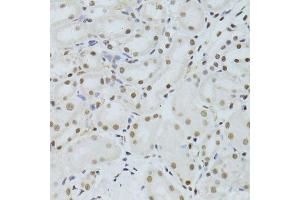 Immunohistochemistry of paraffin-embedded mouse kidney using ALYREF antibody. (THO Complex 4 anticorps)