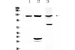 Western blot analysis of MUC1 using anti-MUC1 antibody . (MUC1 anticorps  (AA 1062-1139))