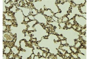 ABIN6268833 at 1/100 staining Mouse lung tissue by IHC-P.