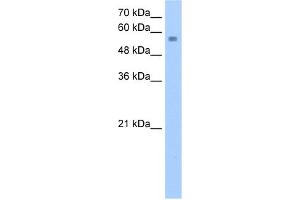 WB Suggested Anti-NUDT12 Antibody Titration:  2. (NUDT12 anticorps  (C-Term))