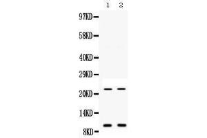 Western blot analysis of Prokineticin 1 expression in mouse liver extract (lane 1) and mouse spleen extract (lane 2).