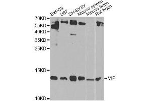 Western blot analysis of extracts of various cell lines, using VIP Antibody. (Vip anticorps  (AA 31-170))