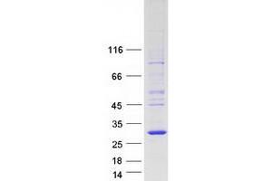 Validation with Western Blot