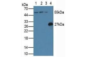 Western blot analysis of (1) Human Jurkat Cells, (2) Human HeLa cells, (3) Human K562 Cells and (4) Rat Spleen Tissue. (FLIP anticorps  (AA 43-281))