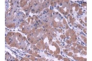 Detection of COVA1 in Human Stomach Tissue using Polyclonal Antibody to Cytosolic Ovarian Carcinoma Antigen 1 (COVA1) (ENOX2 anticorps  (AA 1-207))