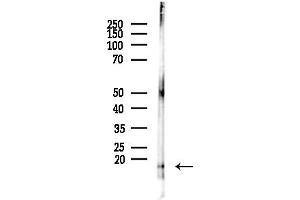 anti-Ribosomal Protein S14 (RPS14) (Internal Region) antibody