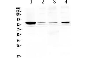 Western blot analysis of RANK using anti-RANK antibody . (TNFRSF11A anticorps  (AA 34-211))