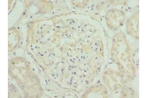 Immunohistochemistry of paraffin-embedded human kidney tissue using ABIN7155891 at dilution of 1:100 (HGD anticorps  (AA 226-445))
