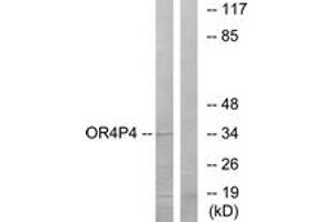 Western blot analysis of extracts from HeLa cells, using OR4P4 Antibody. (OR4P4 anticorps  (AA 260-309))