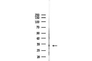 Western blot analysis of lysates from Hela cells(heat-shock, 45 min treatment), using prouty 4 Antibody at 1/1000 dilution.