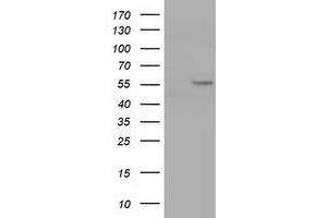 Western Blotting (WB) image for anti-Cytochrome P450, Family 1, Subfamily A, Polypeptide 2 (CYP1A2) antibody (ABIN1497715) (CYP1A2 anticorps)