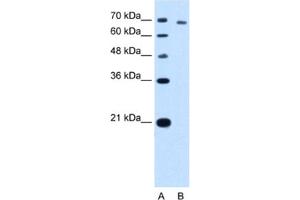 Western Blotting (WB) image for anti-threonyl-tRNA Synthetase (TARS) antibody (ABIN2462975) (TARS anticorps)