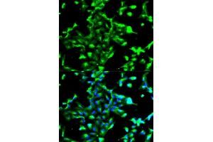 Immunofluorescence analysis of A549 cell using ANXA2 antibody. (Annexin A2 anticorps)