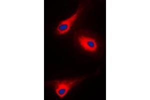 Immunofluorescent analysis of PLC gamma 1 (pY1253) staining in A431 cells. (Phospholipase C gamma 1 anticorps  (C-Term, pTyr1253))
