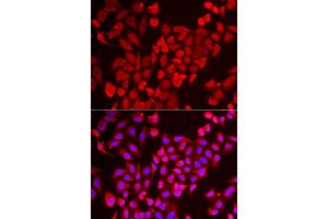 Immunofluorescence analysis of U2OS cells using TNP2 antibody (ABIN5974101). (TNP2 anticorps)