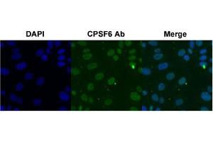 Immunofluorescent staining of SK-OV-3 cell with CPSF6 polyclonal antibody  under 4 ug/mL working concentration. (CPSF6 anticorps  (AA 261-310))