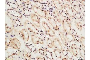 Formalin-fixed and paraffin embedded rat kidney tissue labeled with Rabbit Anti-ERCC6 Polyclonal Antibody, Unconjugated (ABIN2173875) at 1:200 followed by conjugation to the secondary antibody and DAB staining